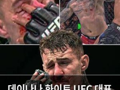 데이나나 화이트 UFC 대표 아스피날 시력 문제 언급
