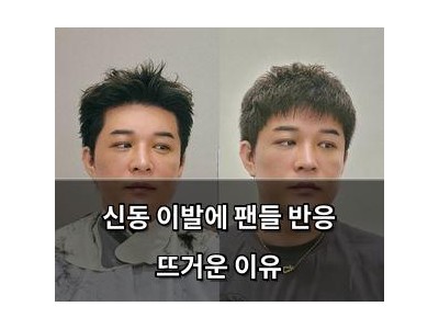 신동 이발에 팬들 반응 뜨거운 이유